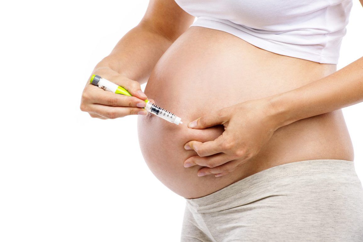 Pregnant woman with Type 1 diabetes using insulin during pregnancy